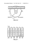 Medical-use two part reactive adhesive and medical-use resin having self-degradation property diagram and image