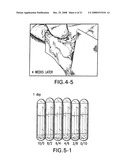 Medical-use two part reactive adhesive and medical-use resin having self-degradation property diagram and image