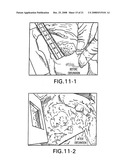 Medical-use two part reactive adhesive and medical-use resin having self-degradation property diagram and image