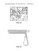 Medical-use two part reactive adhesive and medical-use resin having self-degradation property diagram and image