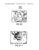 Medical-use two part reactive adhesive and medical-use resin having self-degradation property diagram and image