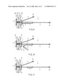 Living body wall fixing tool used in endoscope diagram and image