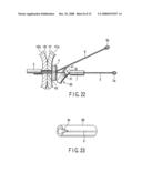 Living body wall fixing tool used in endoscope diagram and image