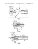 Living body wall fixing tool used in endoscope diagram and image