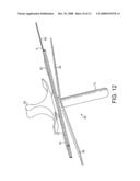 Sensor diagram and image