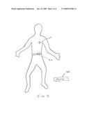 Implantable Biotelemetry Device diagram and image