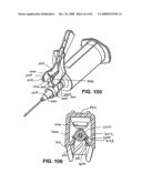 Safety Blood Collection Assembly With Indicator diagram and image