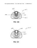 Safety Blood Collection Assembly With Indicator diagram and image