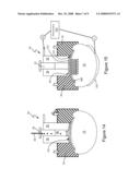 METHOD AND SYSTEM FOR TREATING OF ONYCHOMYCOSIS WITH AN APPLICATOR HAVING A GEL MEDICAMENT LAYER diagram and image