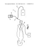 Compound Delivery Tube diagram and image