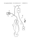 Compound Delivery Tube diagram and image