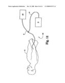 Compound Delivery Tube diagram and image