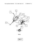 Medical Device for Generating Transient Bubbles diagram and image