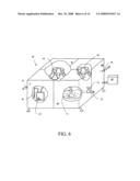 Cells isolation system for breast augmentation and reconstruction diagram and image