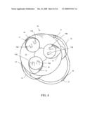 Cells isolation system for breast augmentation and reconstruction diagram and image