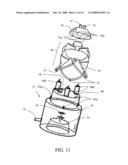 Cells isolation system for breast augmentation and reconstruction diagram and image