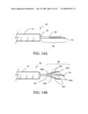 Cells isolation system for breast augmentation and reconstruction diagram and image