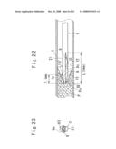 Medical catheter and a catheter assemble diagram and image