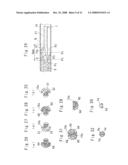 Medical catheter and a catheter assemble diagram and image