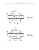 Devices and Methods for Delivering Therapeutic Substances for the Treatment of Sinusitis and Other Disorders diagram and image