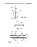 Devices and Methods for Delivering Therapeutic Substances for the Treatment of Sinusitis and Other Disorders diagram and image