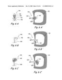 Devices and Methods for Delivering Therapeutic Substances for the Treatment of Sinusitis and Other Disorders diagram and image