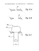 Devices and Methods for Delivering Therapeutic Substances for the Treatment of Sinusitis and Other Disorders diagram and image