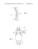 Methods and devices for treating bone after high velocity and/or trauma fracture diagram and image