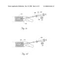 Methods and devices for treating bone after high velocity and/or trauma fracture diagram and image