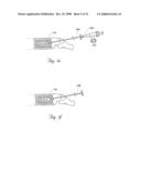 Methods and devices for treating bone after high velocity and/or trauma fracture diagram and image