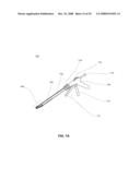 METHODS AND DEVICES FOR REDUCING GASTRIC VOLUME diagram and image