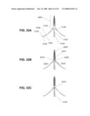 METHODS AND DEVICES FOR REDUCING GASTRIC VOLUME diagram and image