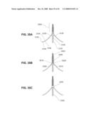 METHODS AND DEVICES FOR REDUCING GASTRIC VOLUME diagram and image