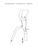 Laparoscopic Instrument diagram and image