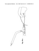 Laparoscopic Instrument diagram and image