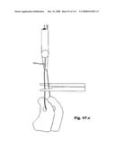 Laparoscopic Instrument diagram and image