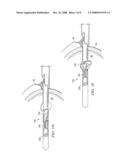 KNOTLESS SUTURE ANCHOR HAVING DISCRETE POLYMER COMPONENTS AND RELATED METHODS diagram and image