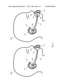 PACIFIER ACCOMMODATION DEVICE diagram and image