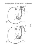 PACIFIER ACCOMMODATION DEVICE diagram and image