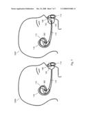 PACIFIER ACCOMMODATION DEVICE diagram and image