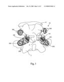 SYSTEM AND METHOD FOR FACET JOINT REPLACEMENT diagram and image