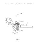 SYSTEM AND METHOD FOR FACET JOINT REPLACEMENT diagram and image