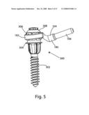 SYSTEM AND METHOD FOR FACET JOINT REPLACEMENT diagram and image