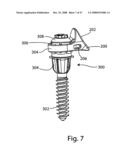 SYSTEM AND METHOD FOR FACET JOINT REPLACEMENT diagram and image