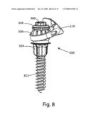 SYSTEM AND METHOD FOR FACET JOINT REPLACEMENT diagram and image