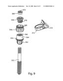 SYSTEM AND METHOD FOR FACET JOINT REPLACEMENT diagram and image