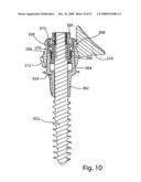 SYSTEM AND METHOD FOR FACET JOINT REPLACEMENT diagram and image