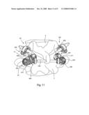 SYSTEM AND METHOD FOR FACET JOINT REPLACEMENT diagram and image