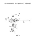 SYSTEM AND METHOD FOR FACET JOINT REPLACEMENT diagram and image