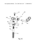 SYSTEM AND METHOD FOR FACET JOINT REPLACEMENT diagram and image